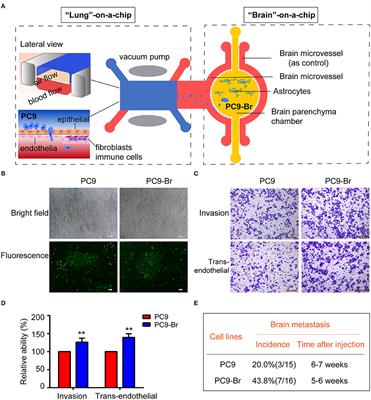 Proteomic Reveals Reasons for Acquired Drug Resistance in Lung Cancer Derived Brain Metastasis Based on a Newly Established Multi-Organ Microfluidic Chip Model